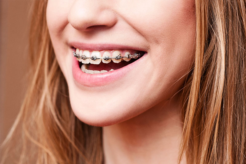 Orthodontics in Bedford